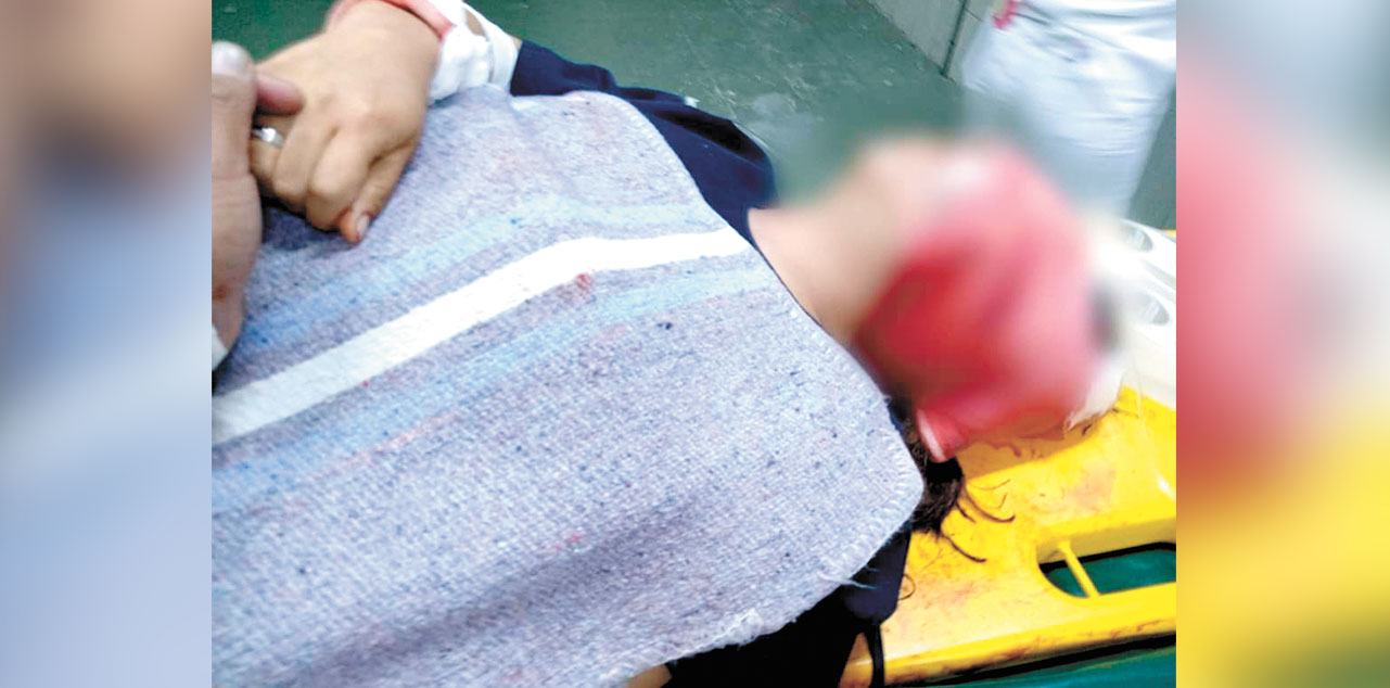 Shirley N.G.P., de 28 años, fue brutalmente agredida por su expareja. Foto: FELCV